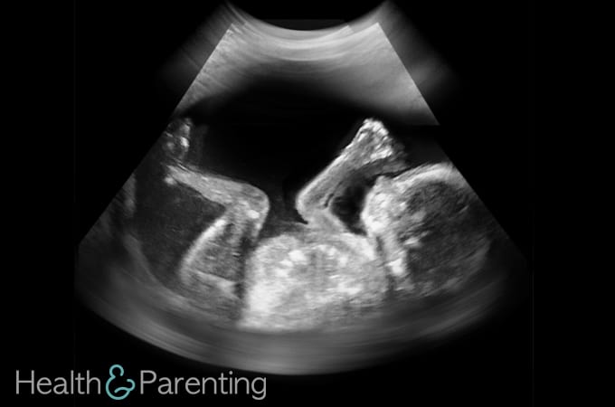 How Do Ultrasounds Work? - Health & Parenting